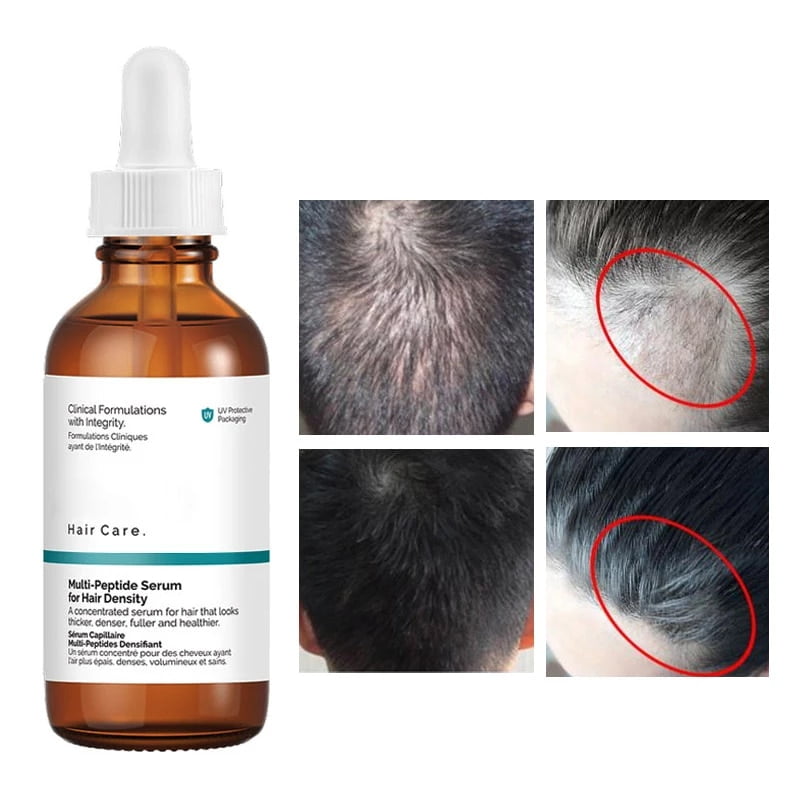 Serum para el Cabello | The Ordinary