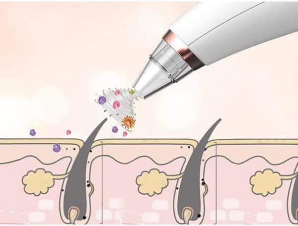 Limpiador Facial | Poros Abiertos e Imperfecciones