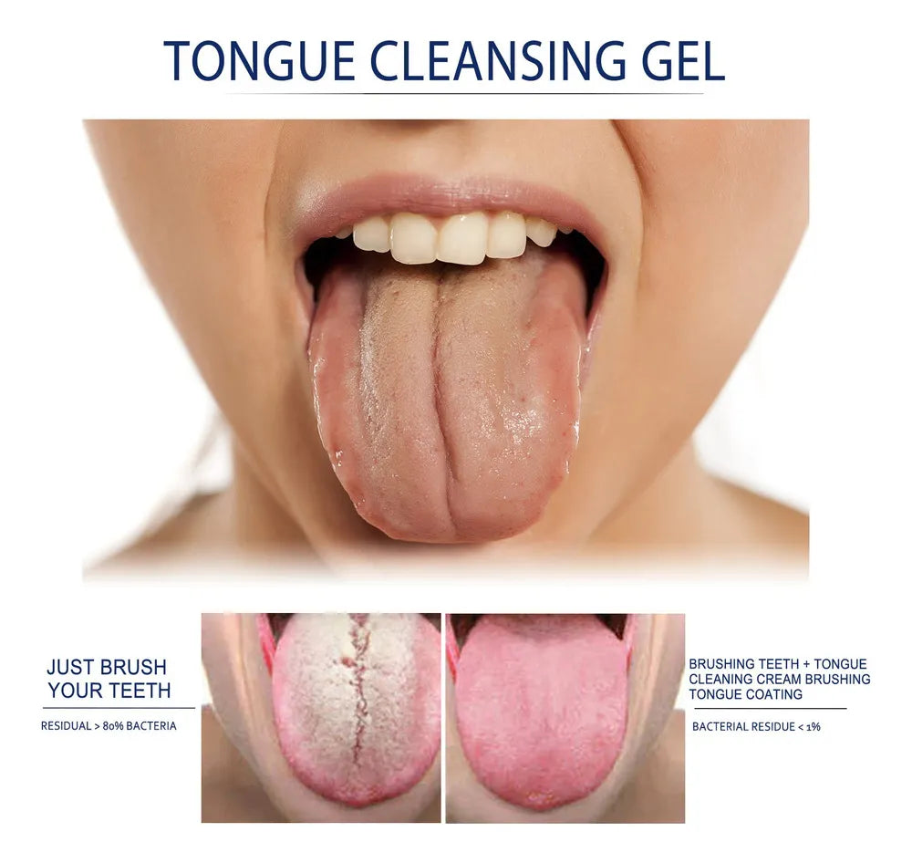 Gel Higienizante Bucal
