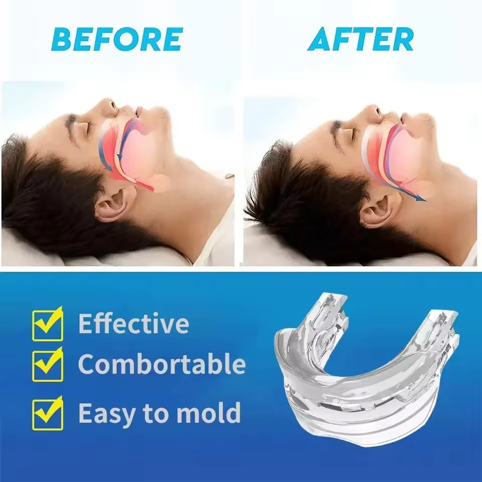 Aparato Bucal Antirronquido
